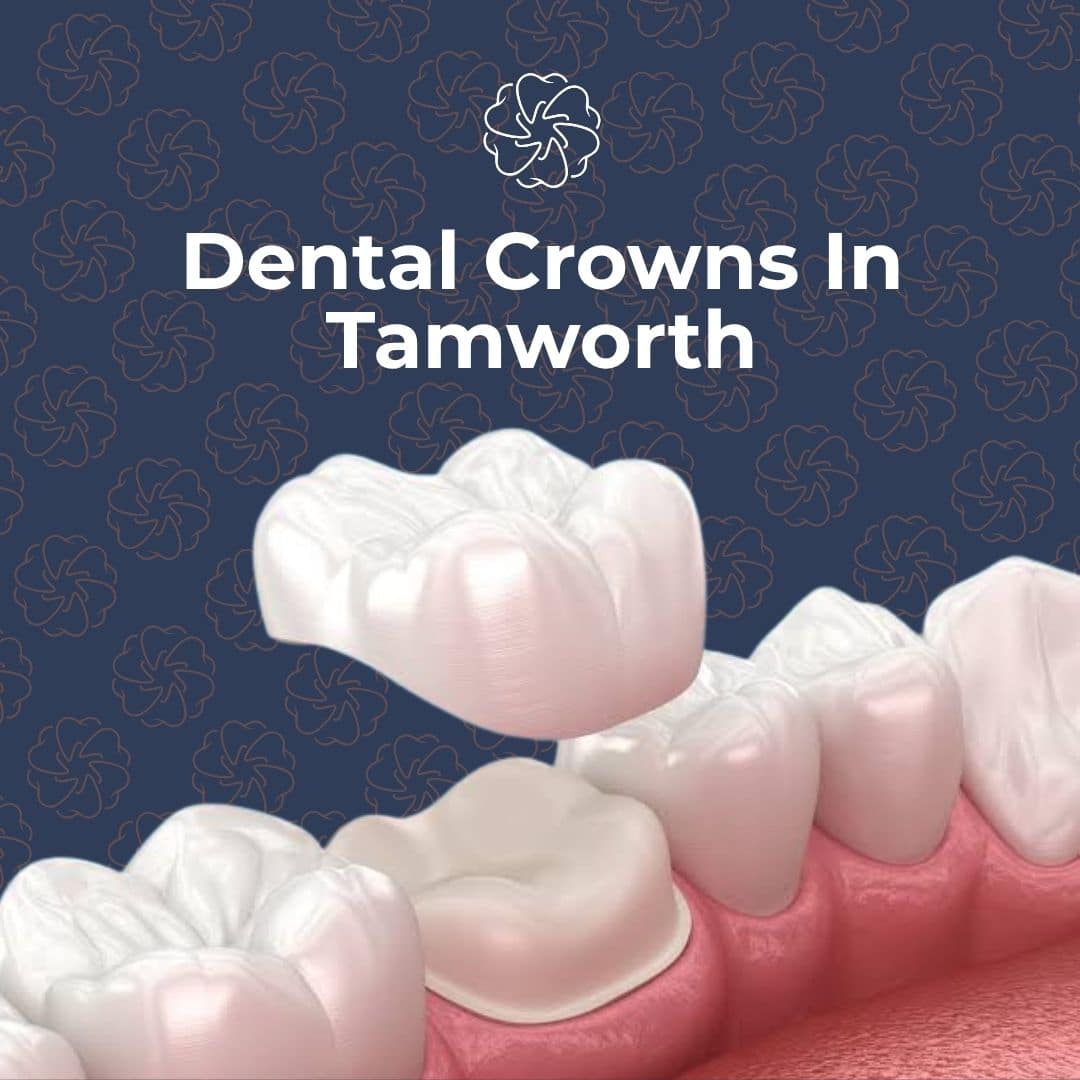 Dental crown In Tamworth