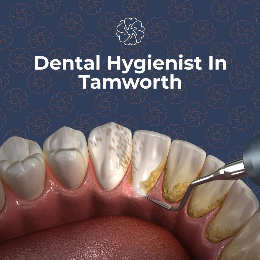Dental hygiene in tamworth