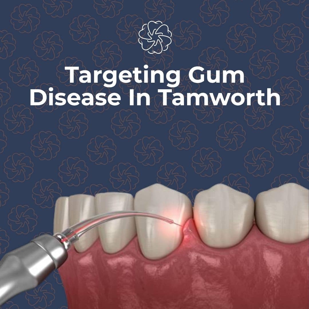 Gum disease in tamworth