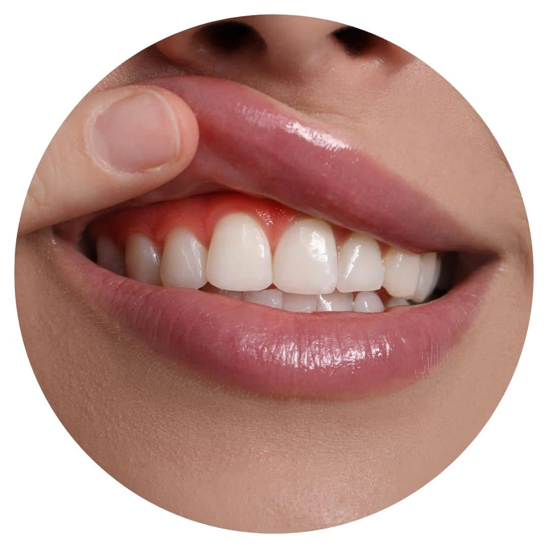 gum disease In Tamworth