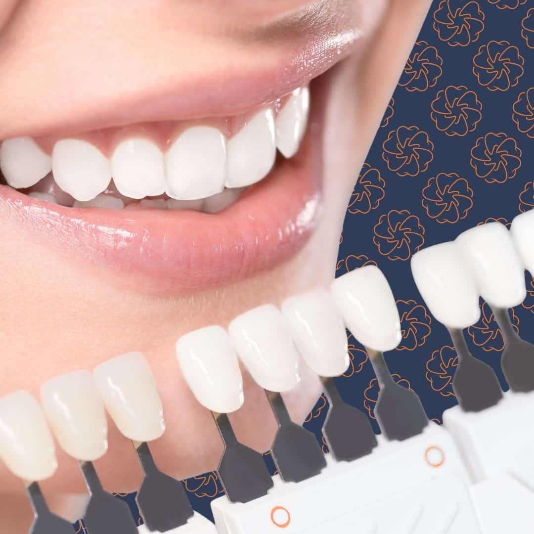 Dale House Dental patient smiling