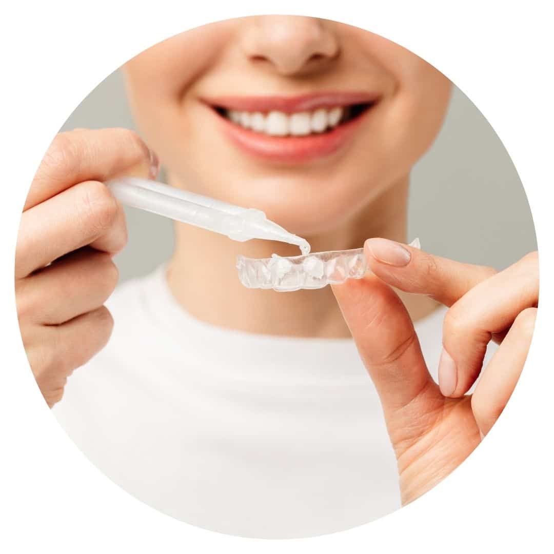 teeth whitening In Tamworth