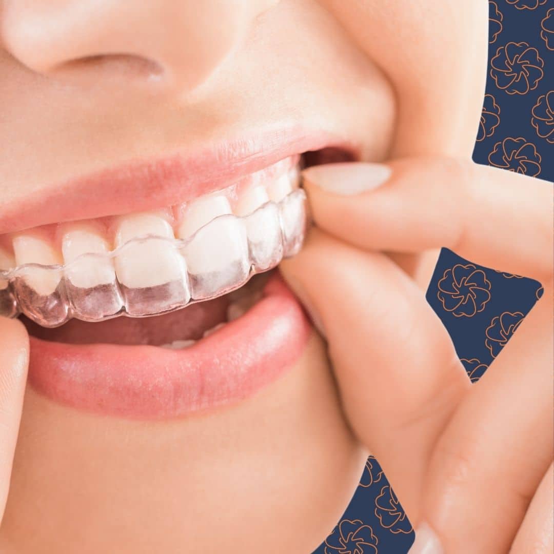 Dale House Dental patient smiling