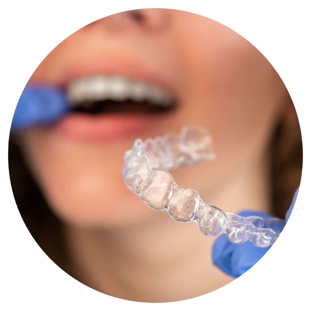 Invisalign In Tamworth