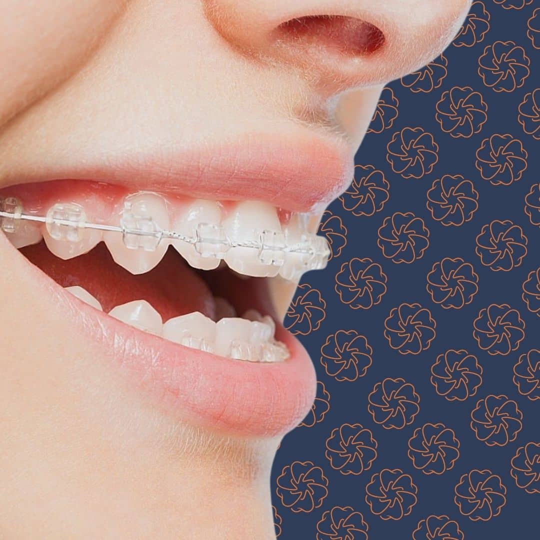 Dale House Dental patient smiling