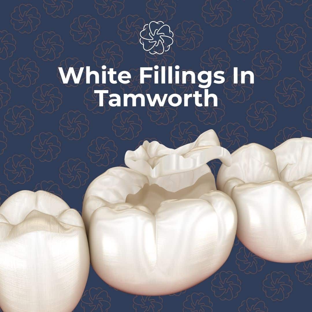 White Fillings In Tamworth