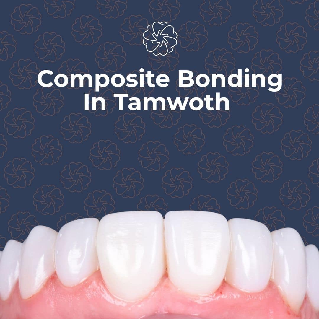 Composite bonding In Tamworth