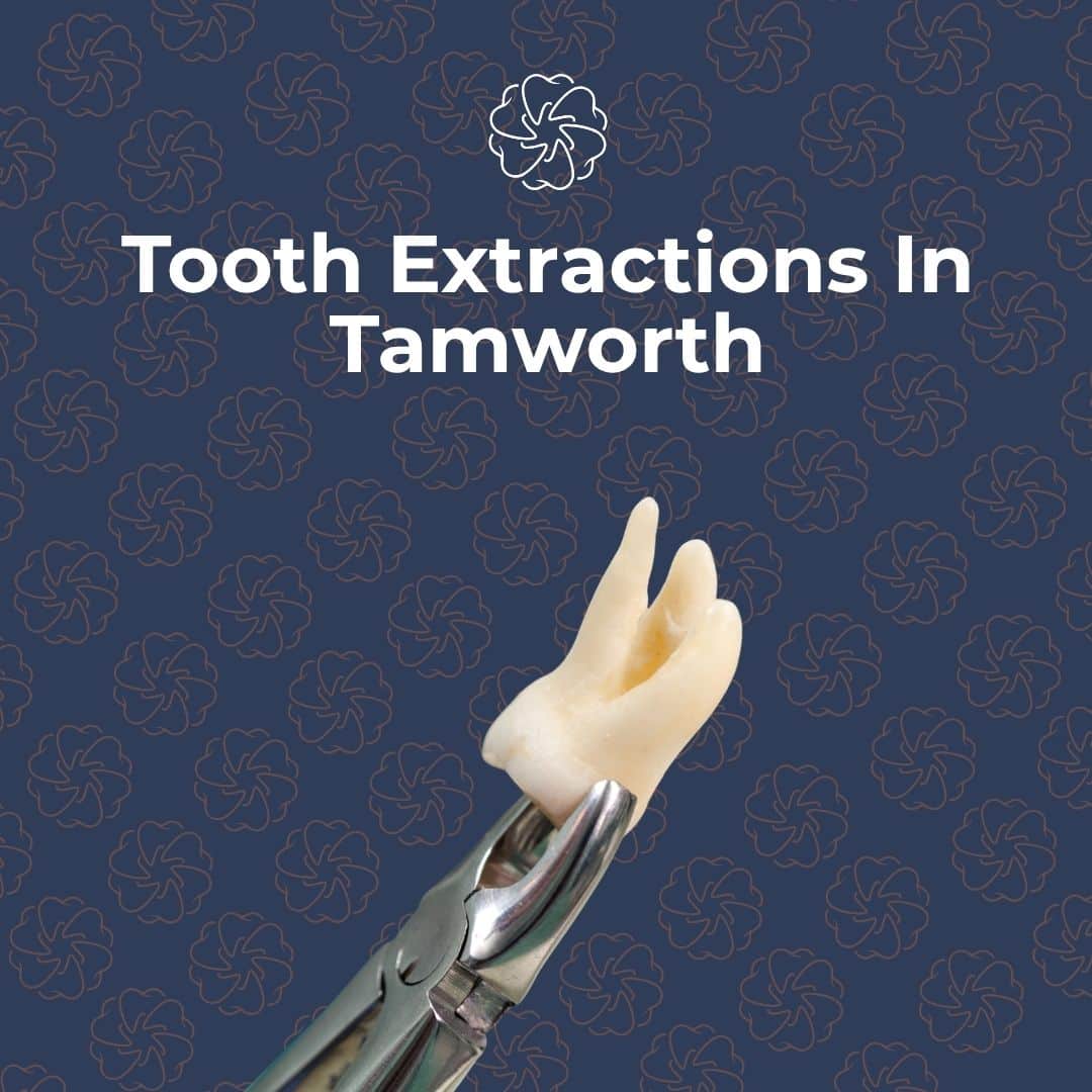 tooth extractions in tamworth