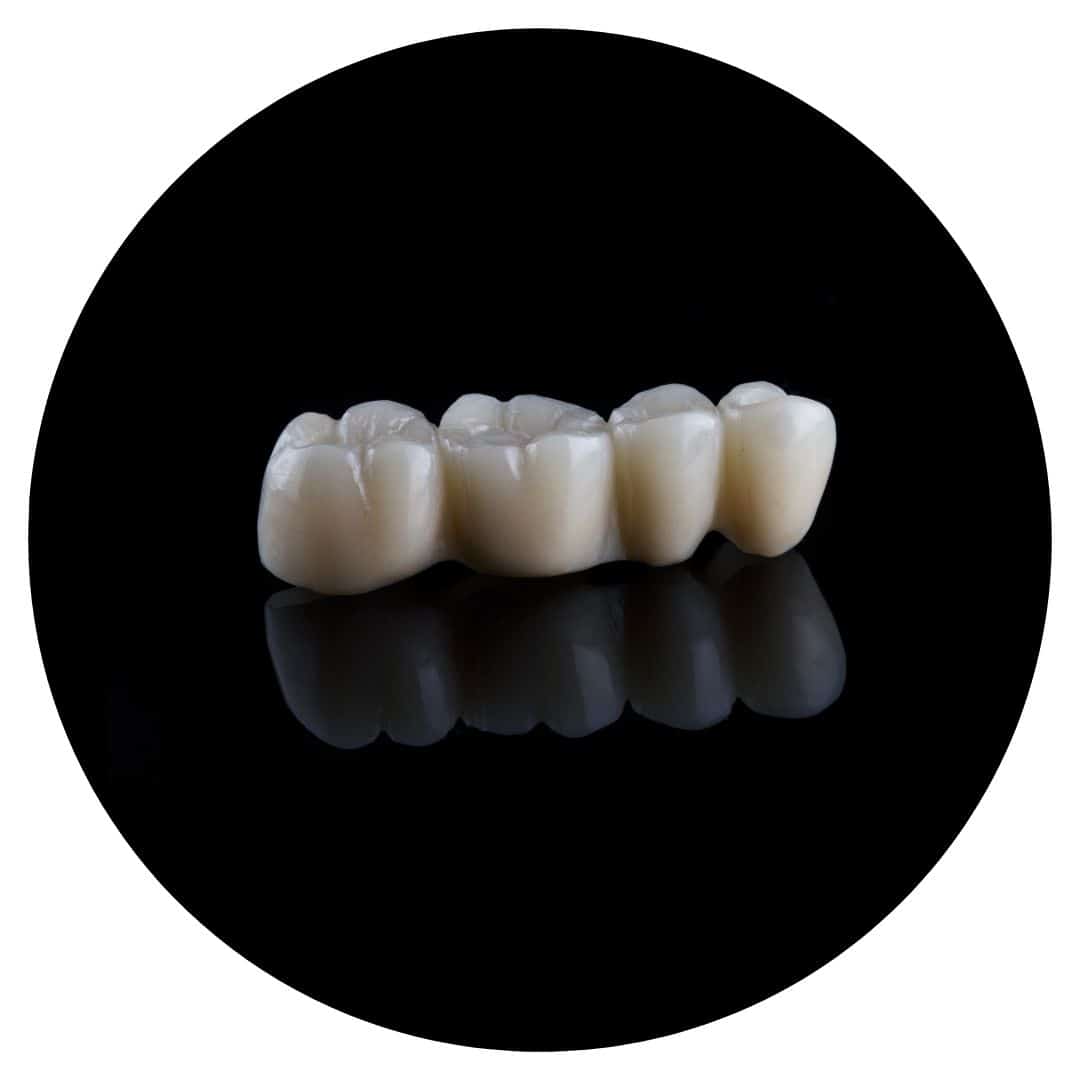 Dental bridges In Tamworth
