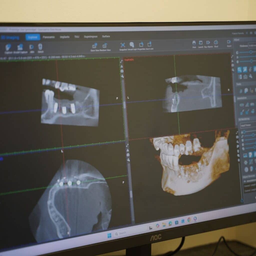 implants in tamworth